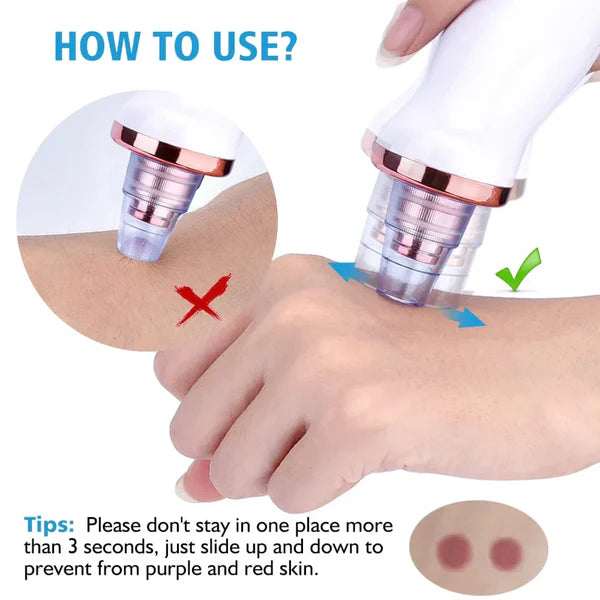 Electric Blackhead Remover | Vacuum Acne & Pore Cleaner | 5 Heads Suction Machine